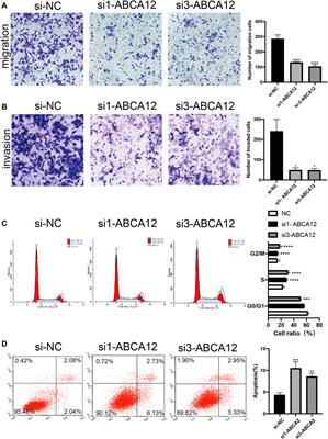 ABCA12 Promotes Proliferation and Migration and Inhibits Apoptosis of Pancreatic Cancer Cells Through the AKT Signaling Pathway